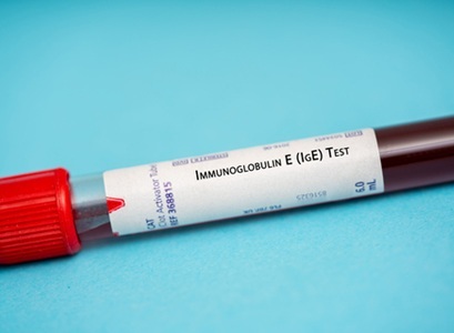  Breaking Down Barriers in Allergy Testing: A Global Call for Diagnostic-First Care