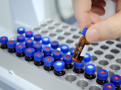 More than AI: Today’s Digital Lab Runs on Samples, Data Management