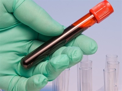 Buyer's Guide: Blood Chemistry Analyzers
