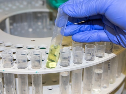  50 Years of Ion Chromatography: What has, and hasn’t, Changed