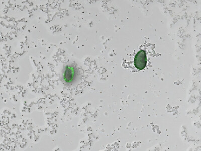 Engineered Bacteria Used to Create Biosensor Which Detects Microplastics