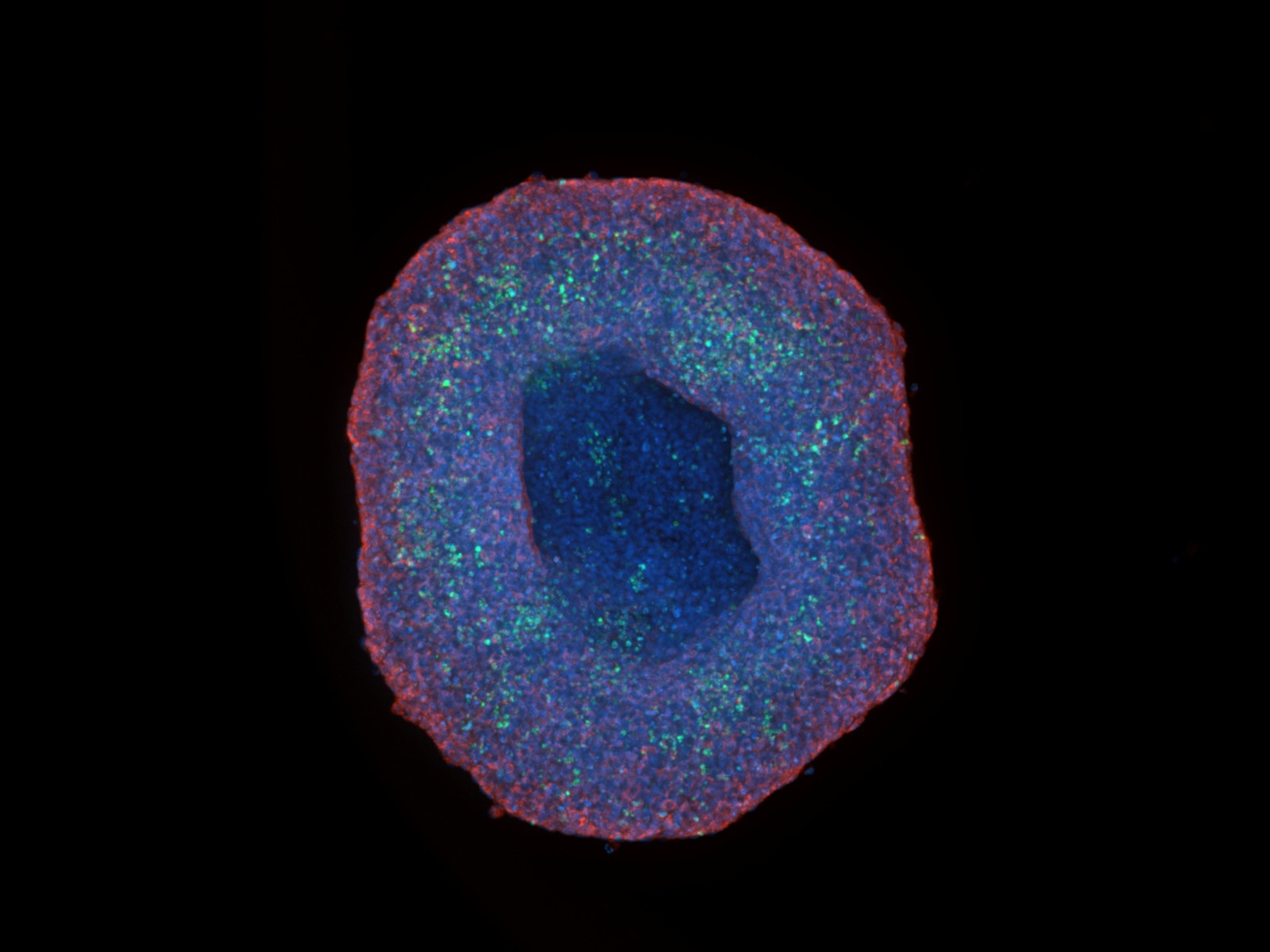 A Clear Look at 3D Spheroids