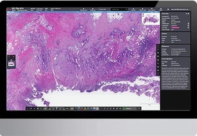  New Upgrades for Digital Pathology Portfolio