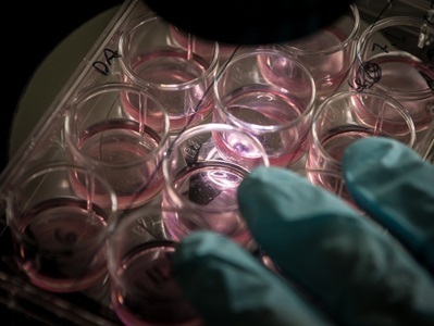 Overcoming Challenges in Live Imaging of 3D Cell Cultures