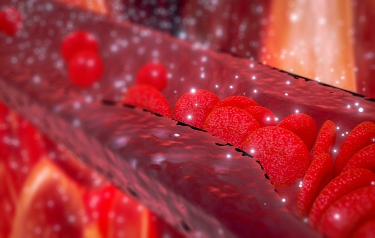 Cholesterol is to Blame for Letting SARS-CoV-2 in