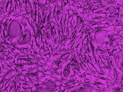 Gentle Sorting for Challenging Cell Applications
