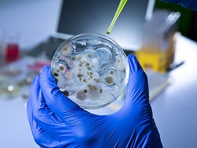 Efficient, Gentle Extraction of Proteins