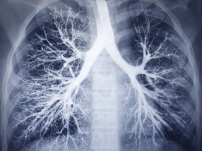  First Breathing Lung-on-chip Developed Using Genetically Identical Cells