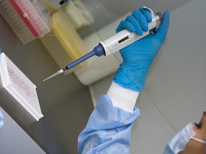 Buyer’s Guide: ELISA Kits
