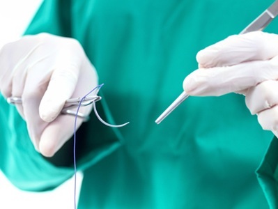 Surgical Stitches Loaded with Anti-inflammatory Medication