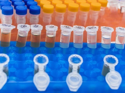 Team Tracks Multiple Cancer-causing Viruses in Wastewater