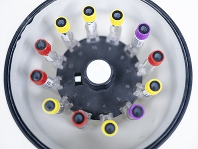 Lab Equipment in 60 Seconds: Biochemistry Analyzers