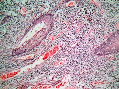  The End-to-end Lab Journey of HPV Self-collection Samples
