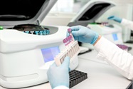 Discrete Analyzer