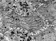Transmission Electron Microscope (TEM)