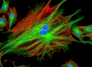Fluorescence Imaging System