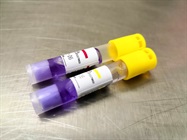 Clinical Diagnostics Controls
