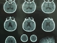 Medical Imaging Systems