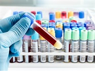 Toxicology Controls