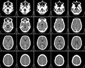 Laboratory Computed Tomography (CT) Devices
