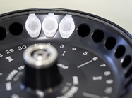 Inductively Coupled Plasma Mass Spectrometer (ICP MS)