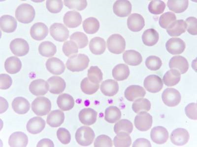 Platelet Aggregation Systems (Aggregometer)