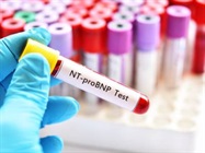 Cardiac Marker Analyzers