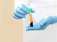 Plasma Protein Analyzers