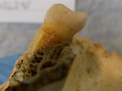 DNA from 4,000-year-old Teeth Show Evolution of the Human Diet