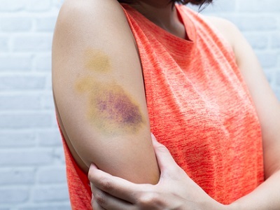 AI Tool can Predict Patients at Risk of Intimate Partner Violence